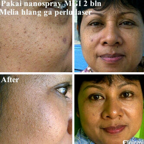 Nano Spray Facial Self Care