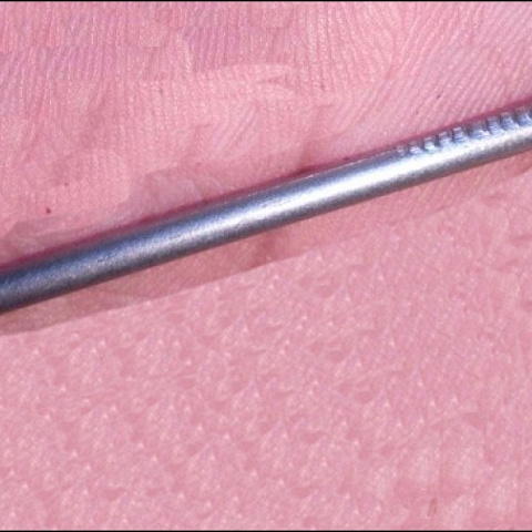 Common Nails